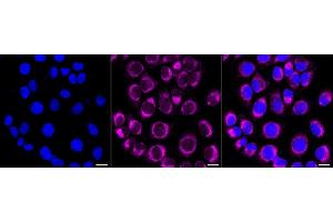 Immunocytochemical staining of HT- cells with PTPN1/2 antibody (ABIN7800964), 1:1,000).