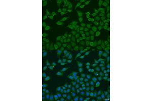 Immunofluorescence analysis of U2OS cells using PLG4C antibody (ABIN6132097, ABIN6145730, ABIN6145731 and ABIN6223698) at dilution of 1:100. (PLA2G4C antibody  (AA 1-189))