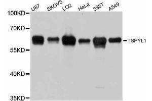 Western blot analysis of extracts of various cell lines, using TSPYL1 antibody (ABIN5999118) at 1:3000 dilution.