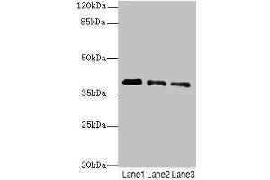 Western blot All lanes: RP2antibody at 3. (RP2 antibody  (AA 1-350))