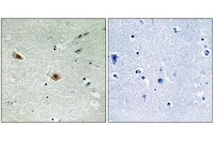 Immunohistochemical analysis of paraffin-embedded human brain tissue using Retinoblastoma (Phospho-Ser608) antibody (left)or the same antibody preincubated with blocking peptide (right). (Retinoblastoma 1 antibody  (pSer608))