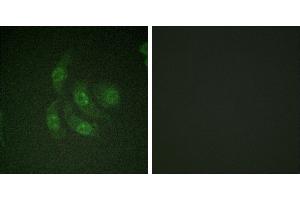 Peptide - +Immunofluorescence analysis of HepG2 cells, using CaMK4 (Ab-196/200) antibody. (CAMK4 antibody  (Thr196))