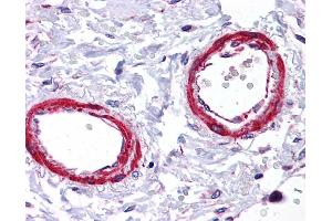 Immunohistochemistry (IHC) image for anti-Sirtuin 5 (SIRT5) (Middle Region) antibody (ABIN405300) (SIRT5 antibody  (Middle Region))