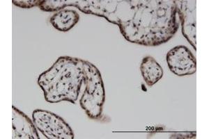 Image no. 1 for anti-Integrin-Linked Kinase-Associated Serine/threonine Phosphatase 2C (ILKAP) (AA 293-393) antibody (ABIN599593) (ILKAP antibody  (AA 293-393))
