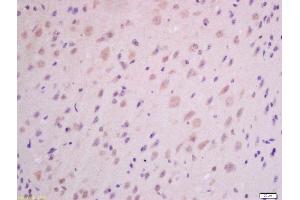 Formalin-fixed and paraffin embedded mouse brain labeled with Anti-GHRH Polyclonal Antibody, Unconjugated (ABIN726275) at 1:300 followed by conjugation to the secondary antibody and DAB staining. (GHRH antibody  (AA 32-59))