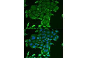Immunofluorescence analysis of HeLa cells using CD84 antibody (ABIN5973833). (CD84 antibody)