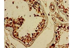 Immunohistochemistry of paraffin-embedded human testis tissue using ABIN7152561 at dilution of 1:100 (BRIP1 antibody  (AA 66-243))