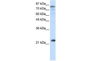 WB Suggested Anti-NFYB Antibody Titration:  0.