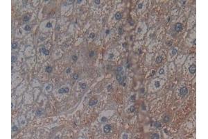 Detection of CRY1 in Human Liver Tissue using Polyclonal Antibody to Cryptochrome 1 (CRY1) (CRY1 antibody  (AA 3-132))