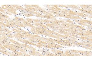 Detection of BMP2 in Human Cardiac Muscle Tissue using Polyclonal Antibody to Bone Morphogenetic Protein 2 (BMP2) (BMP2 antibody  (AA 24-396))