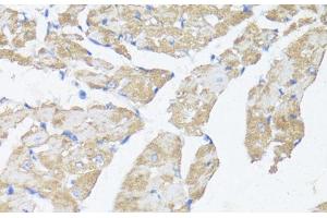 Immunohistochemistry of paraffin-embedded Mouse heart using ASMT Polyclonal Antibody at dilution of 1:100 (40x lens). (ASMT antibody)