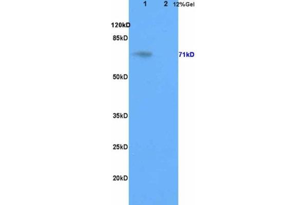 GALC anticorps  (AA 301-400)