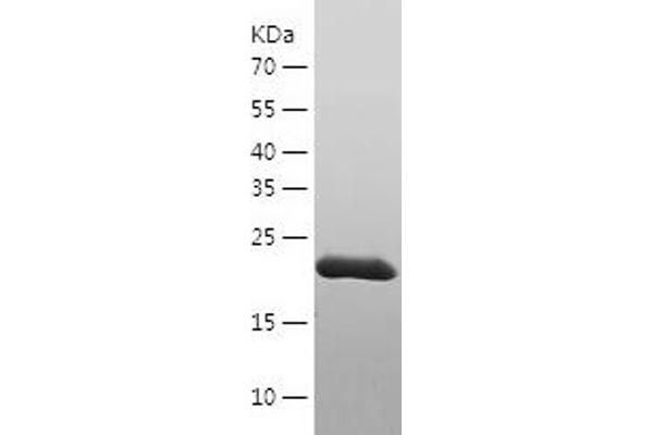 GSTT2 Protein (AA 1-244) (His tag)