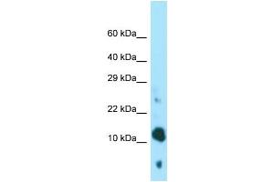 WB Suggested Anti-BEX4 Antibody Titration: 1. (BEX4 antibody  (N-Term))