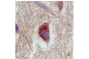 SLC18A1 (VMAT1) in the cortex of human brain was detected using SLC18A1 antibody at a dilution of 5-10 ug/ml and stained with HRP/DAB brown color stain. (SLC18A1 antibody  (Middle Region))