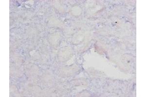Immunohistochemistry of paraffin-embedded human kidney tissue using ABIN7159622 at dilution of 1:20 (MGMT antibody  (AA 4-207))