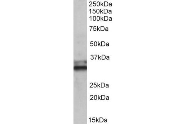 ETFA 抗体  (AA 139-152)