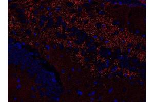Indirect immunostaining of PFA fixed paraffin embedded mouse hippocampus section (dilution 1 : 500; red). (VAMP1, 2, 3 (AA 1-81) antibody)