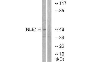 Western Blotting (WB) image for anti-Notchless Homolog 1 (NLE1) (Internal Region) antibody (ABIN1851719) (NLE1 antibody  (Internal Region))