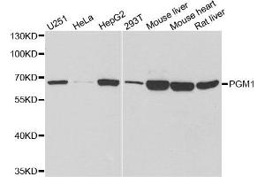 Western Blotting (WB) image for anti-Phosphoglucomutase 1 (PGM1) antibody (ABIN1980319) (Phosphoglucomutase 1 antibody)