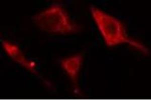 ABIN6278812 staining Hela cells by IF/ICC. (Adenylate Kinase 5 antibody  (N-Term))
