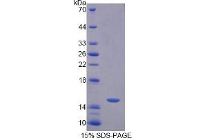 Image no. 1 for CREB Regulated Transcription Coactivator 3 (CRTC3) (AA 1-103) protein (His tag) (ABIN4990147)