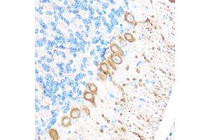Immunohistochemistry of paraffin-embedded Mouse brain using MMP17 Rabbit pAb (ABIN3017219, ABIN3017220, ABIN3017221 and ABIN1680859) at dilution of 1:100 (40x lens). (MMP17 antibody)