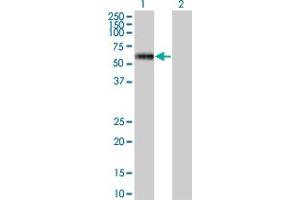 Western Blot analysis of MKNK1 expression in transfected 293T cell line by MKNK1 monoclonal antibody (M09), clone 3C9.
