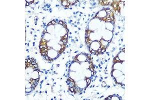 Immunohistochemistry of paraffin-embedded human colon using FUT4 Rabbit pAb (ABIN7267274) at dilution of 1:100 (40x lens). (CD15 antibody  (AA 200-300))
