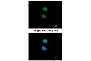 ICC/IF Image Immunofluorescence analysis of paraformaldehyde-fixed HeLa, using ZNF306 , antibody at 1:200 dilution. (ZKSCAN3 antibody)