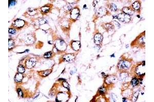 Image no. 2 for anti-Zinc Finger Protein 395 (ZNF395) (Center) antibody (ABIN357344) (ZNF395 antibody  (Center))