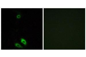 Immunofluorescence (IF) image for anti-Aldo-Keto Reductase Family 1, Member C-Like 1 (AKR1CL1) (Internal Region) antibody (ABIN1850722) (AKR1CL1 antibody  (Internal Region))