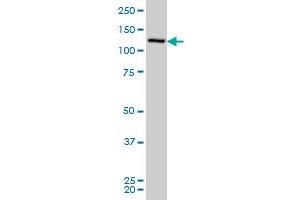 CHERP monoclonal antibody (M01), clone 2H5 Western Blot analysis of CHERP expression in IMR-32 . (CHERP antibody  (AA 795-883))