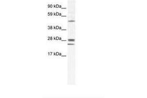 Image no. 1 for anti-Gap Junction Protein, beta 2, 26kDa (GJB2) (AA 85-134) antibody (ABIN202090) (GJB2 antibody  (AA 85-134))