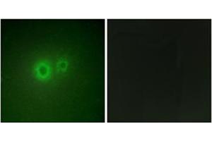 Immunofluorescence analysis of HuvEc cells, using LRAT Antibody . (LRAT antibody  (Internal Region))