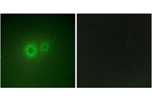 Immunofluorescence analysis of HuvEc cells, using LRAT Antibody .