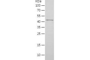 Western Blotting (WB) image for Melanoma Antigen Family B, 1 (MAGEB1) (AA 1-347) protein (His tag) (ABIN7283024) (MAGEB1 Protein (AA 1-347) (His tag))