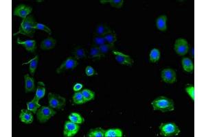 Immunofluorescent analysis of A431 cells using ABIN7153629 at dilution of 1:100 and Alexa Fluor 488-congugated AffiniPure Goat Anti-Rabbit IgG(H+L) (GJB7 antibody  (AA 41-75))