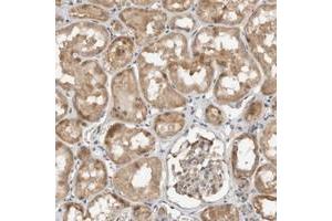 Immunohistochemical staining of human kidney with GINS4 polyclonal antibody  shows moderate cytopolasmic positivity in tubular cells. (GINS4 antibody)