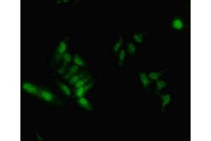 Immunofluorescent analysis of Hela cells using ABIN7155138 at dilution of 1:100 and Alexa Fluor 488-congugated AffiniPure Goat Anti-Rabbit IgG(H+L) (HNRNPA2B1 antibody  (AA 1-249))