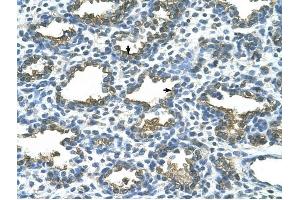 ALPP antibody was used for immunohistochemistry at a concentration of 4-8 ug/ml to stain Alveolar cells (arrows) in Human Lung. (PLAP antibody)
