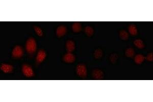Immunofluorescent analysis of A549 cells using ABIN7152464 at dilution of 1:100 and Cy3-congugated Goat Anti-Rabbit IgG (FBXL18 antibody  (AA 1-365))
