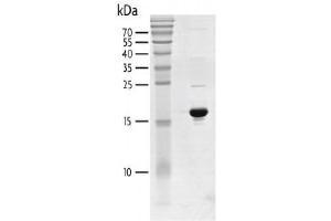 Recombinant BRD2 (344-455) protein gel. (BRD2 Protein (AA 344-455) (His tag,DYKDDDDK Tag))