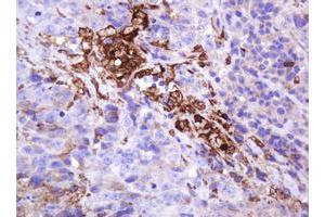 Image no. 2 for anti-Mucin 1 (MUC1) antibody (ABIN1499598) (MUC1 antibody)