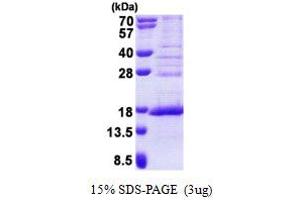 SDS-PAGE (SDS) image for Family With Sequence Similarity 119A (FAM119A) (AA 93-218) protein (His tag) (ABIN6387219) (FAM119A Protein (AA 93-218) (His tag))
