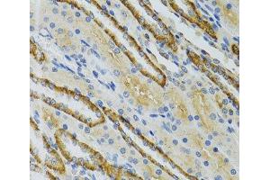 Immunohistochemistry of paraffin-embedded Mouse kidney using COG2 Polyclonal Antibody at dilution of 1:100 (40x lens). (COG2 antibody)