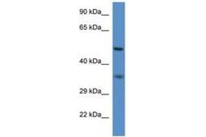 Image no. 1 for anti-Peroxisomal Biogenesis Factor 2 (PEX2) (N-Term) antibody (ABIN6746208) (PEX2 antibody  (N-Term))