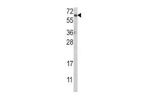 Western blot analysis of AKT1 Antibody (N-term) h in MCF-7 cell line lysates (35 μg/lane). (AKT1 antibody  (N-Term))