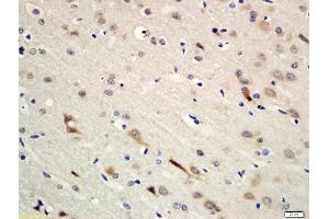 Formalin-fixed and paraffin embedded rat brain tissue labeled with Rabbit Anti-Erbin Polyclonal Antibody, Unconjugated (ABIN2173874) at 1:200 followed by conjugation to the secondary antibody and DAB staining (ERBB2IP antibody  (AA 21-120))