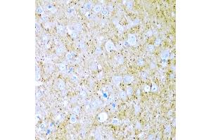 Immunohistochemistry of paraffin-embedded rat brain using WNT2 antibody (ABIN6130801, ABIN6150239, ABIN6150241 and ABIN6221571) at dilution of 1:200 (40x lens). (WNT2 antibody  (AA 26-360))